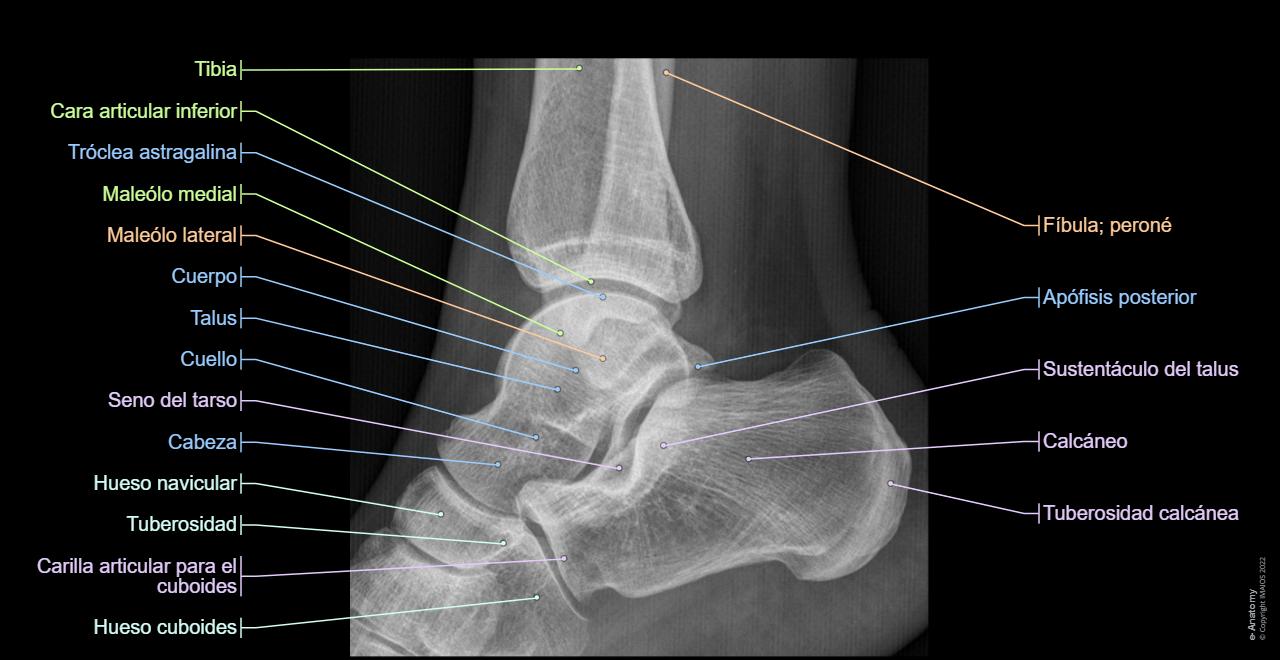 Anatomía De La Radiografía Lateral Del Pie Biomecánica Del Pie Cavo