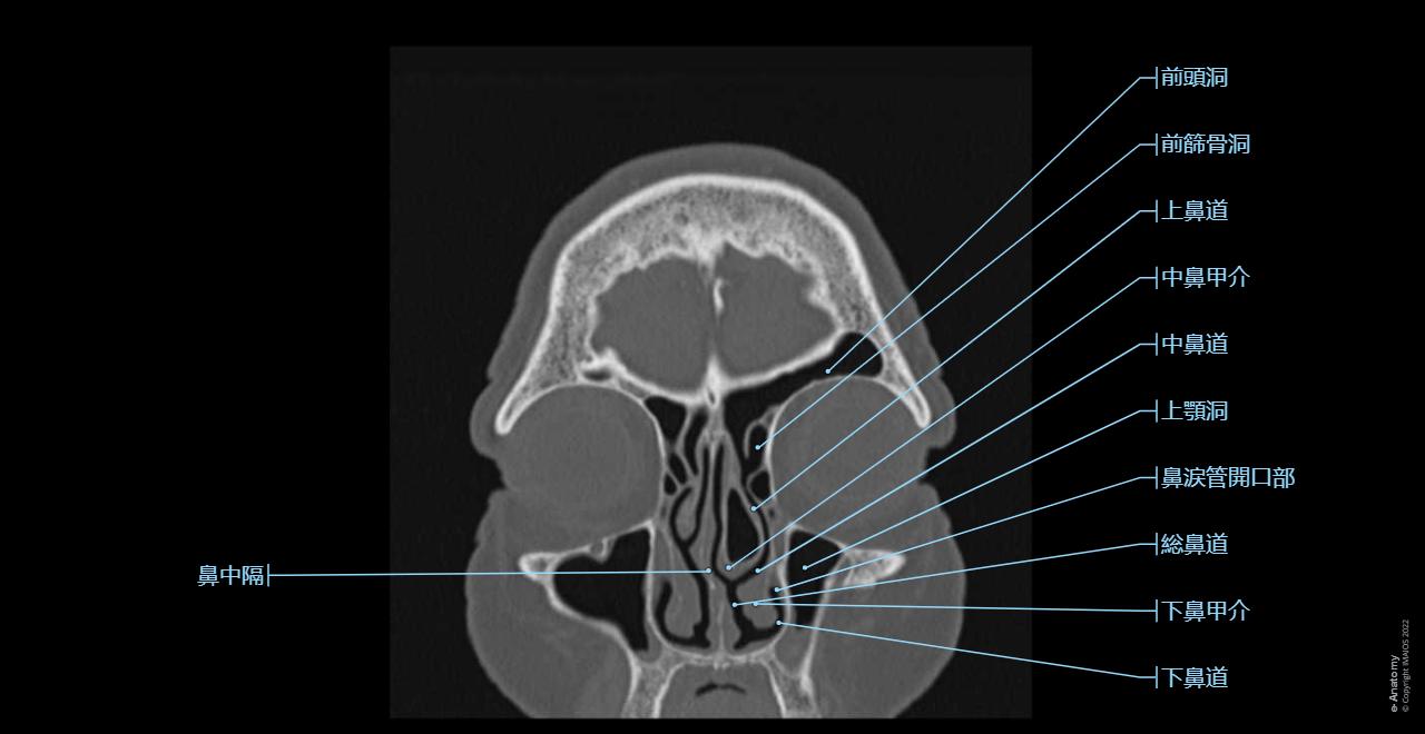 頭頚部 CT: 正常解剖学 | e-Anatomy