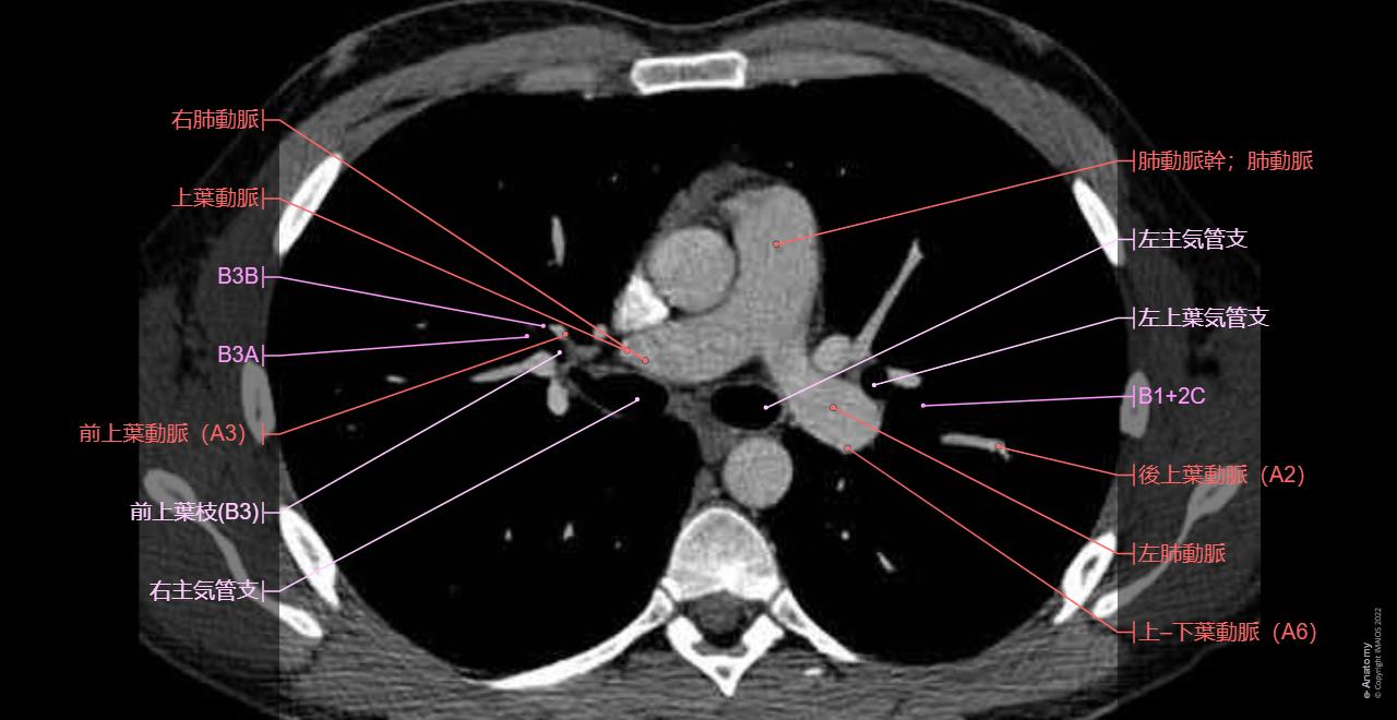 軸位断の肺、縦隔、心臓の解剖 | e-Anatomy