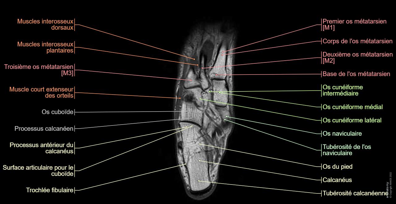 Cheville Pied IRM Anatomie Normale E Anatomy cheville-pied-irm-anatomie-normale-e-anatomy
