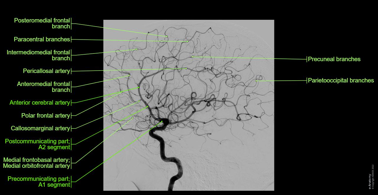 Cerebral Angiogram Anatomy