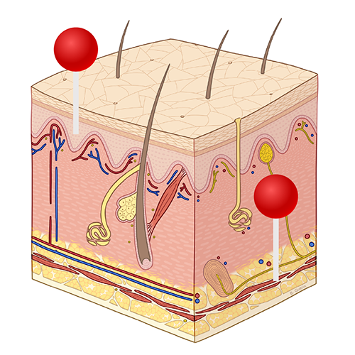 Single Integument Anatomy of the integument: annotated illustrations | e-Anatomy