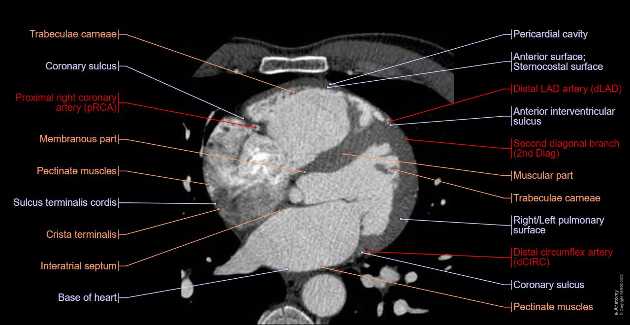 Normal Ctca Circulacin Arterial Trax Anatoma Mdica Anatoma Anatomia Cardiaca