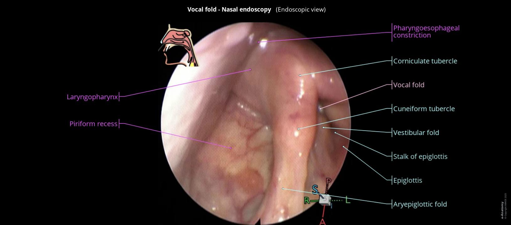 Anatomy of the nasal cavity, pharynx and larynx: endoscopic view - e-Anatomy