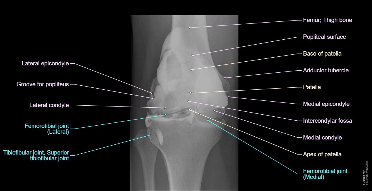 Anatomy of the knee (CT arthrography) | e-Anatomy