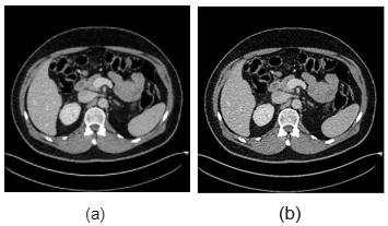 Transforms Sharpness Example Augmentation Deep learning in medical imaging: data augmentation