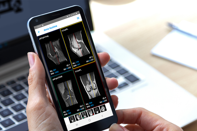Dicom Ios Best mobile DICOM viewer (Android and iOS)