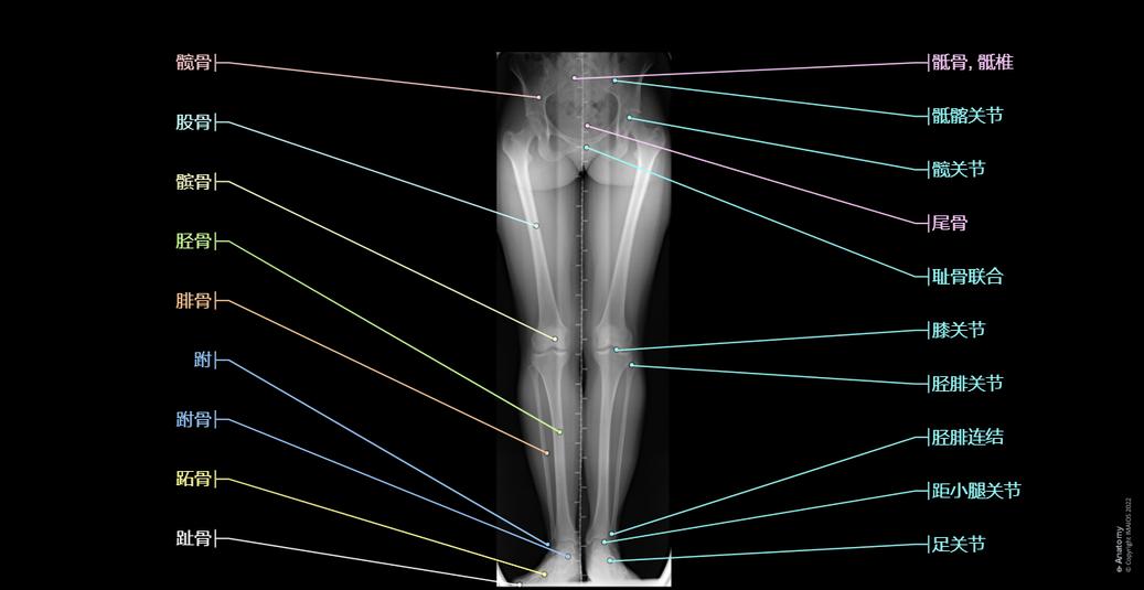 下肢传统X光图 | e-Anatomy