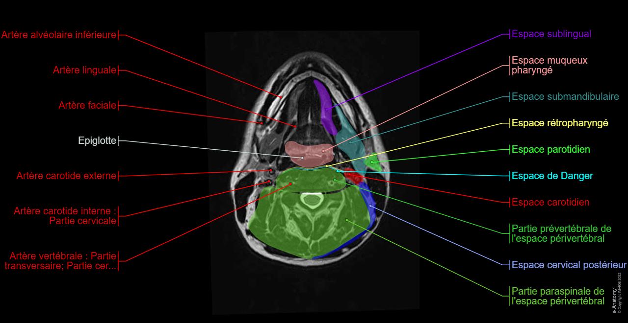 Cou Face et cou IRM : anatomie normale | e-Anatomy