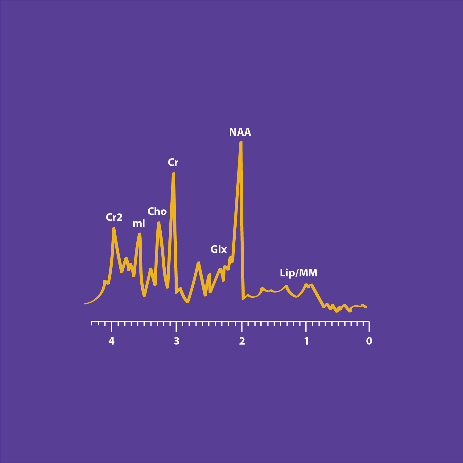 Magnetic Resonance Spectroscopy: metabolites spectroscopy | e-MRI