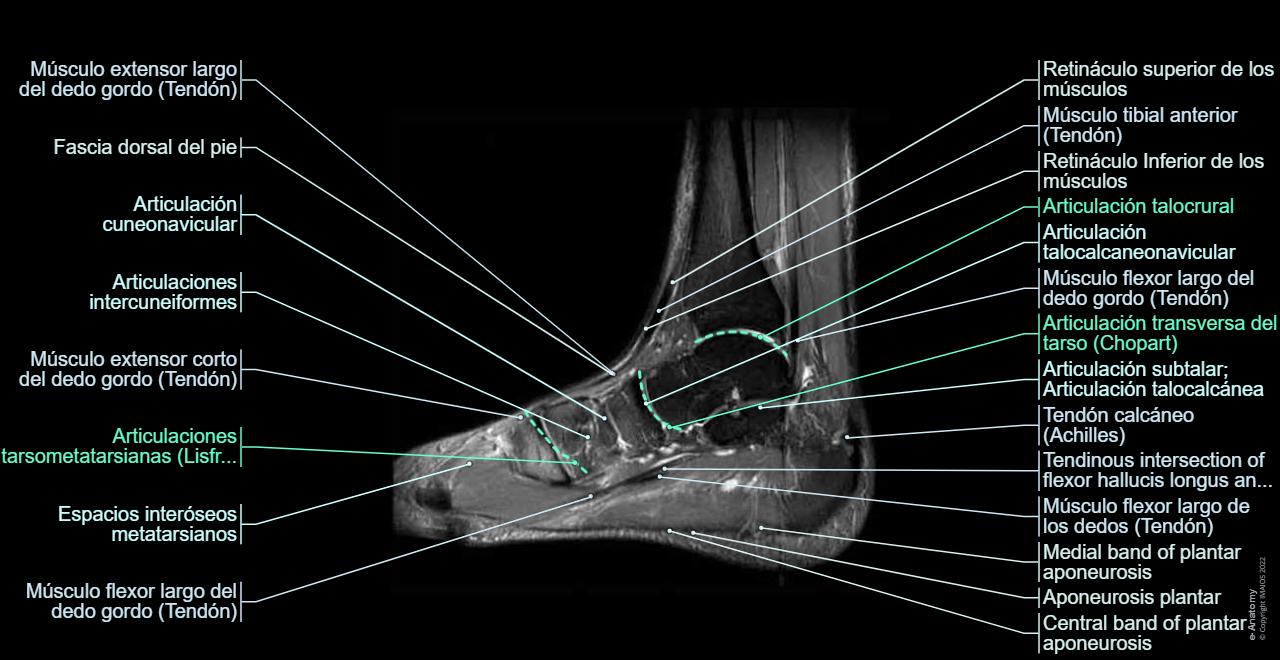 Angulo Tobillo Tobillo y pie IRM : anatomía normal | e-Anatomy