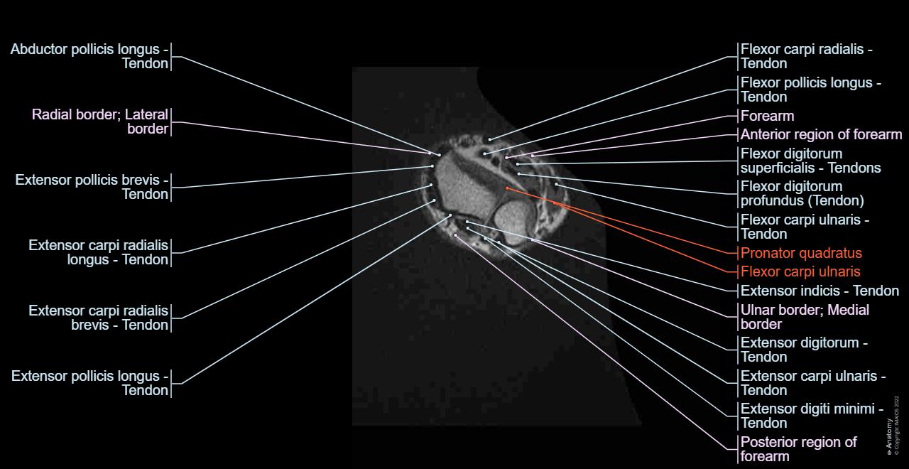 MRI of upper limb: normal anatomy | e-Anatomy