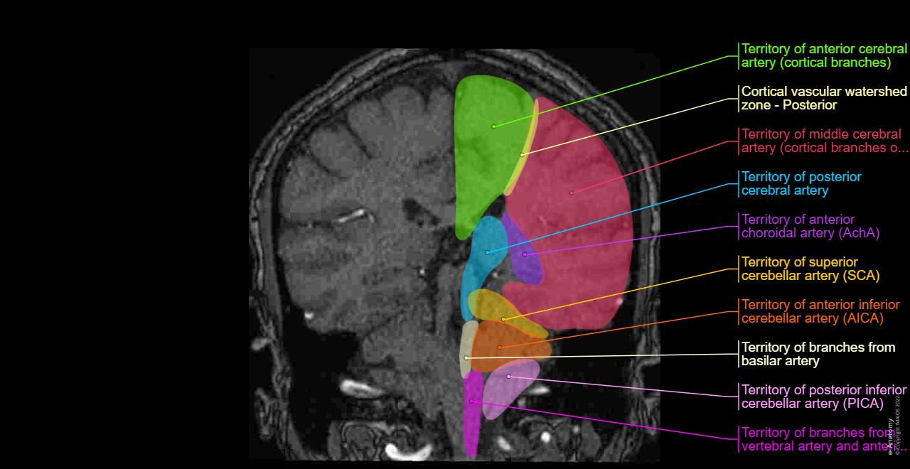 Mra Brain Anatomy 24 Magnetic Resonance Angiography Stock Photos,