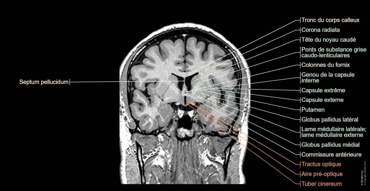 Cerveau IRM 3D : anatomie normale | e-Anatomy