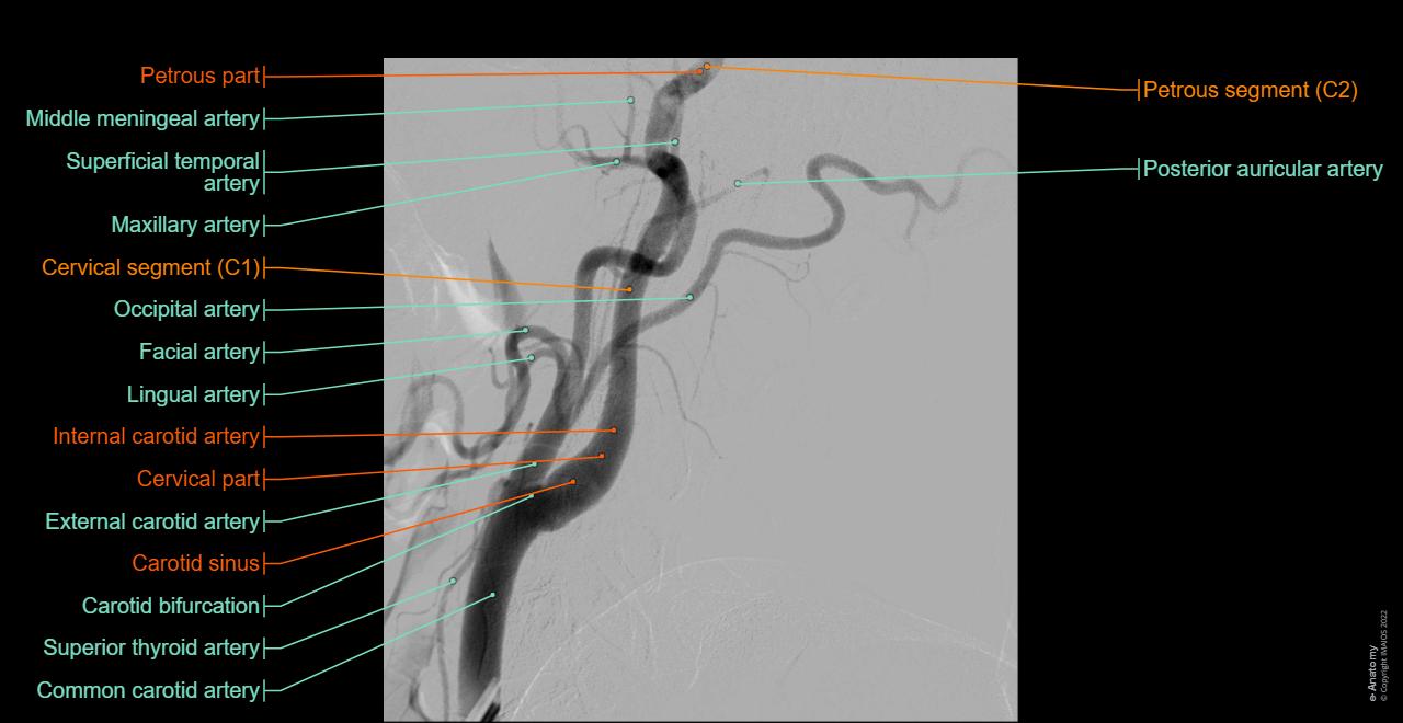 Normal Labelled Angiogram Angiografia delle arterie del cervello: anatomia normale | e-Anatomy