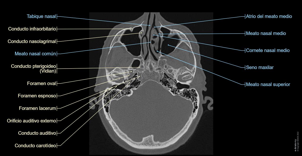 Cabeza TC Anatom a Normal E Anatomy cabeza-tc-anatom-a-normal-e-anatomy