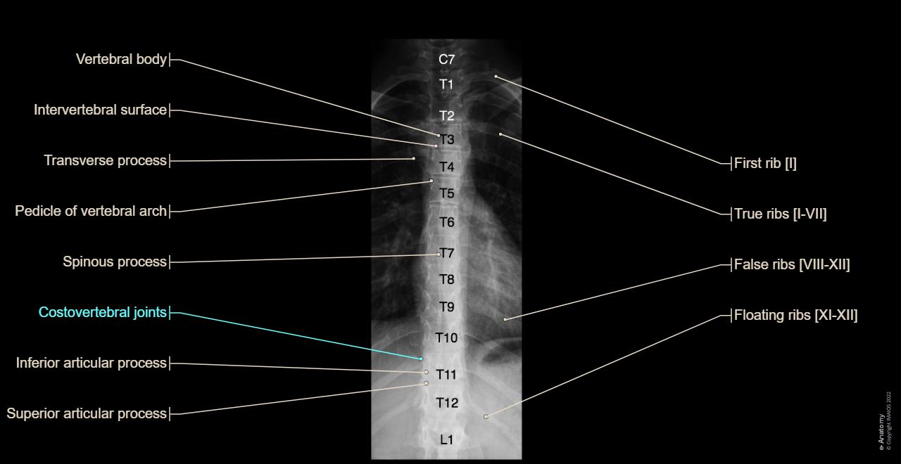 Vertebra Coronal Diagram Of Thoracic Vertebrae And Label