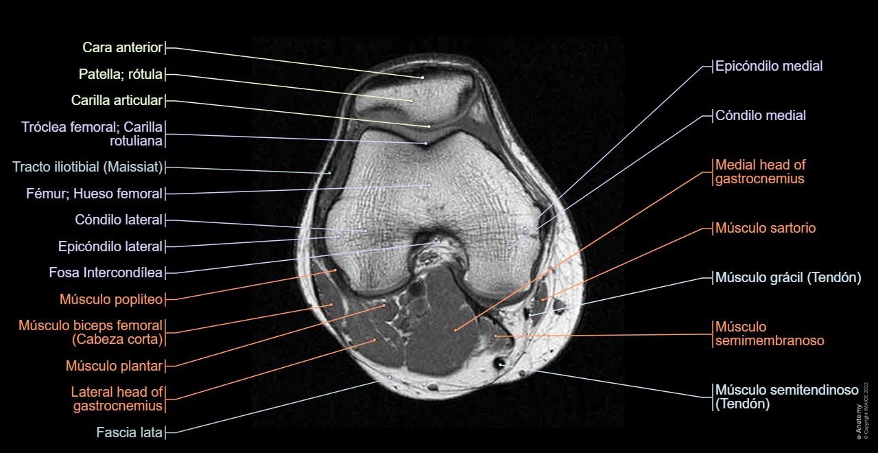 Rotula Netter Anatomía Interactiva De La Rodilla Anatomía: Inervación Cutánea