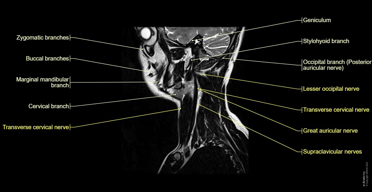 Anatomy of the face and neck (MRI) : normal anatomy | e-Anatomy