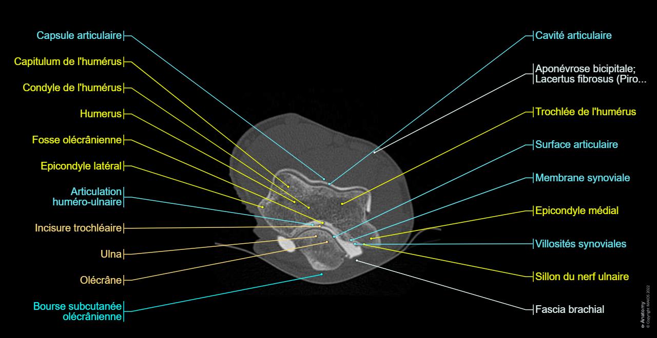 Arthroscanner Du Coude Anatomie Normale E Anatomy arthroscanner-du-coude-anatomie-normale-e-anatomy