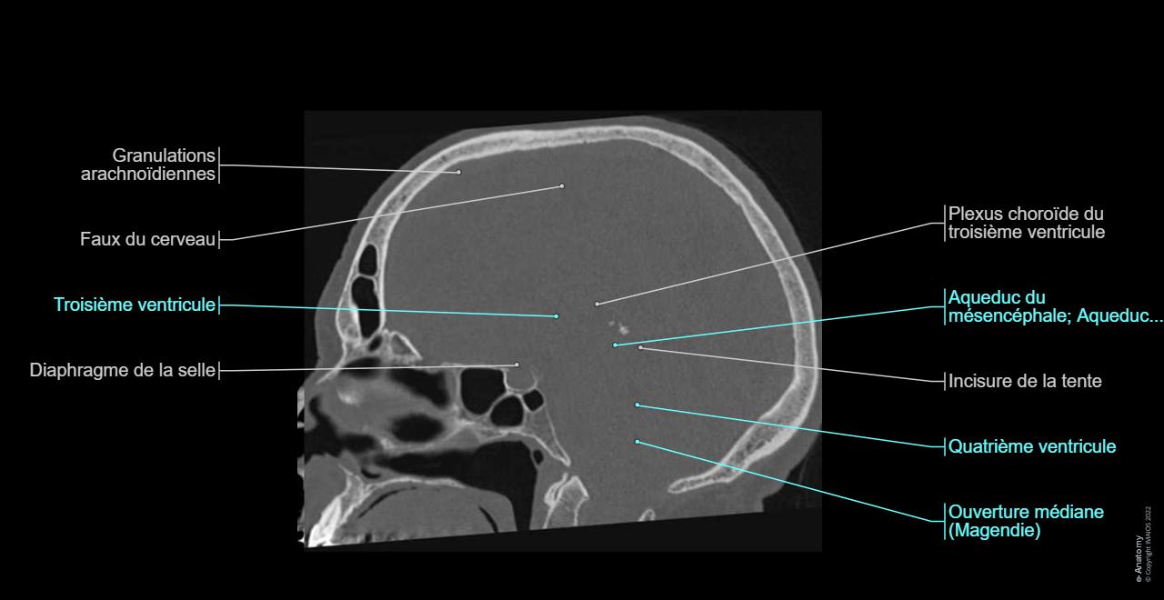 Anatomie du crâne : scanner légendé - e-Anatomy