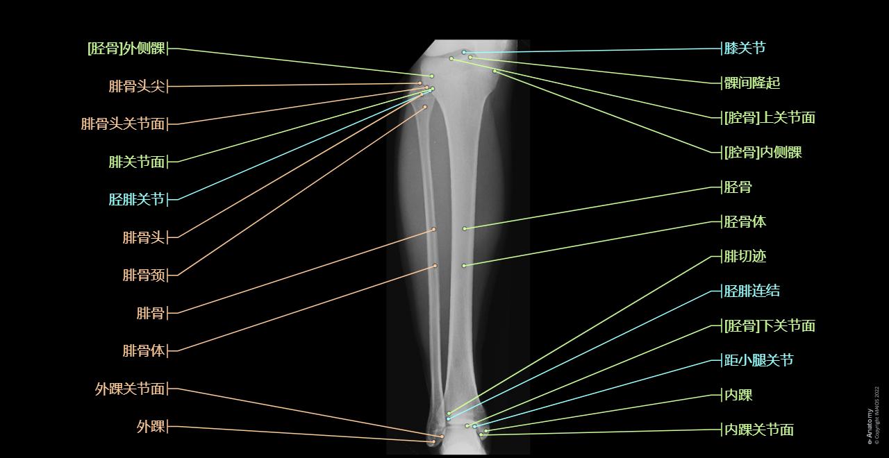 下肢传统X光图 | e-Anatomy