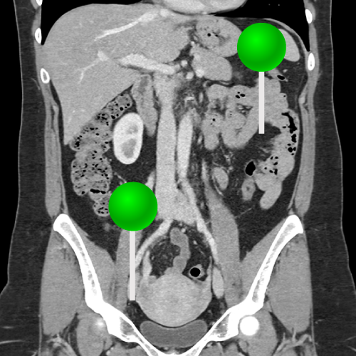 Anatomy of the female abdomen and pelvis on CT - e-Anatomy
