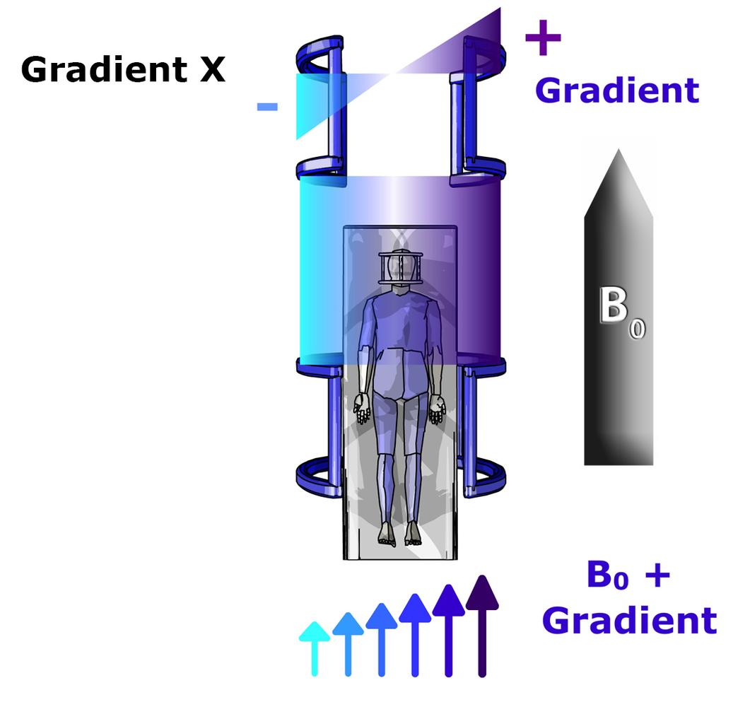 Magnetogram Gradient MRI instrumentation and safety: magnetic field gradients | e-MRI