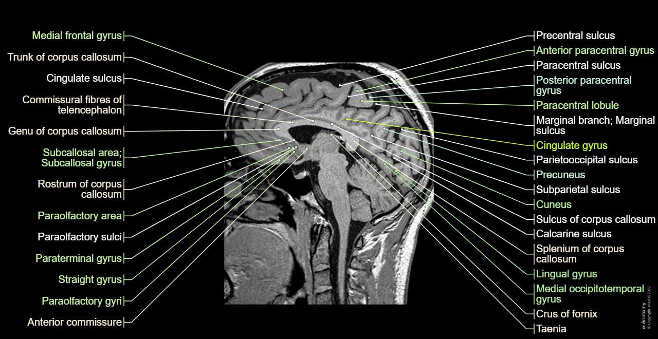 뇌 MRI 3D: 정상 해부학 |e-Anatomy
