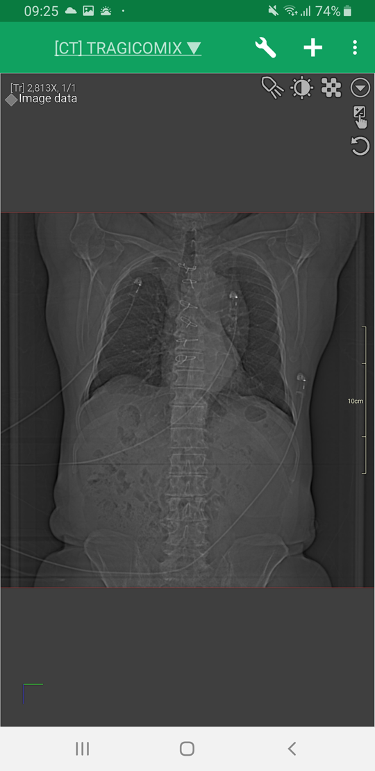Dicom Ios Best mobile DICOM viewer (Android and iOS)
