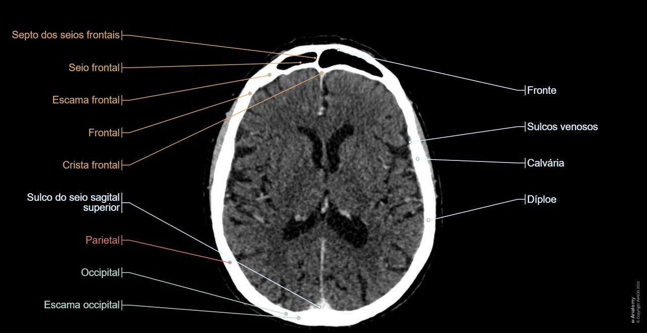Cr nio TC Anatomia Normal E Anatomy cr-nio-tc-anatomia-normal-e-anatomy