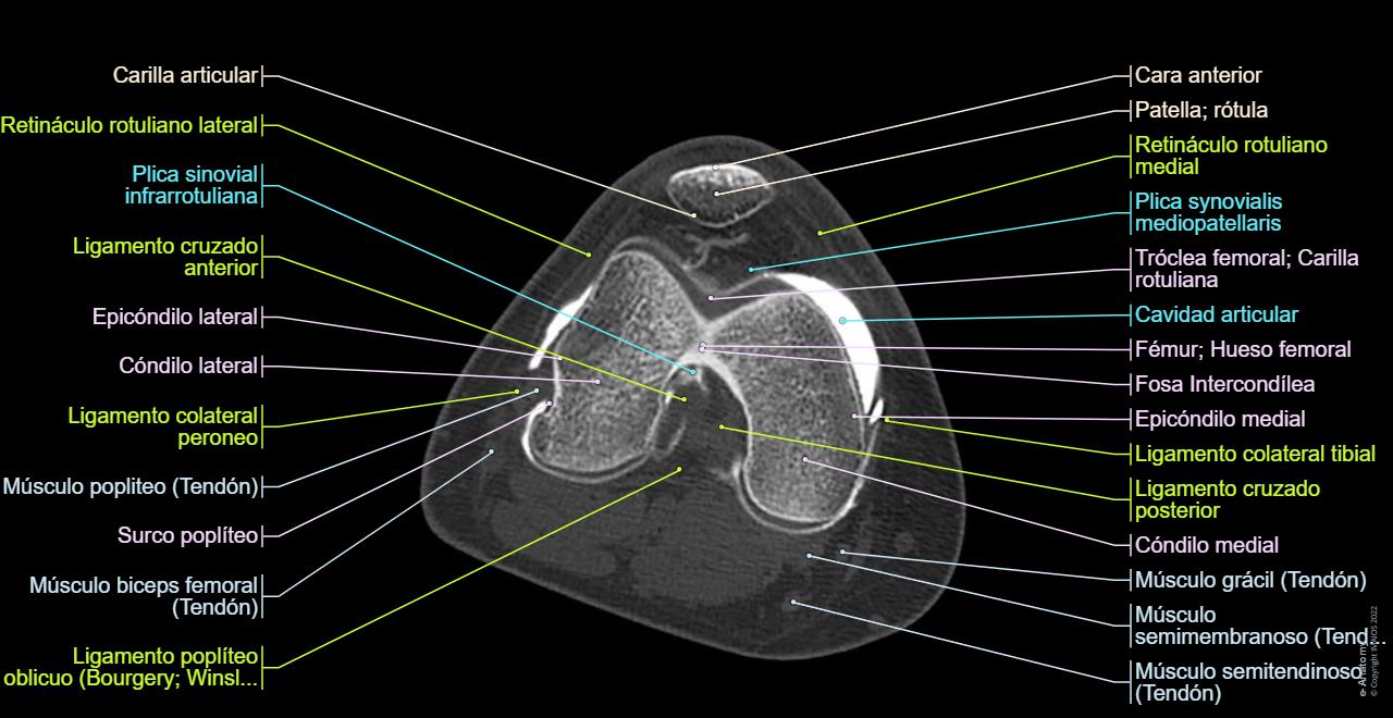 Anatomía De La Rodilla Por Resonancia Magnética El 3D Duplica La