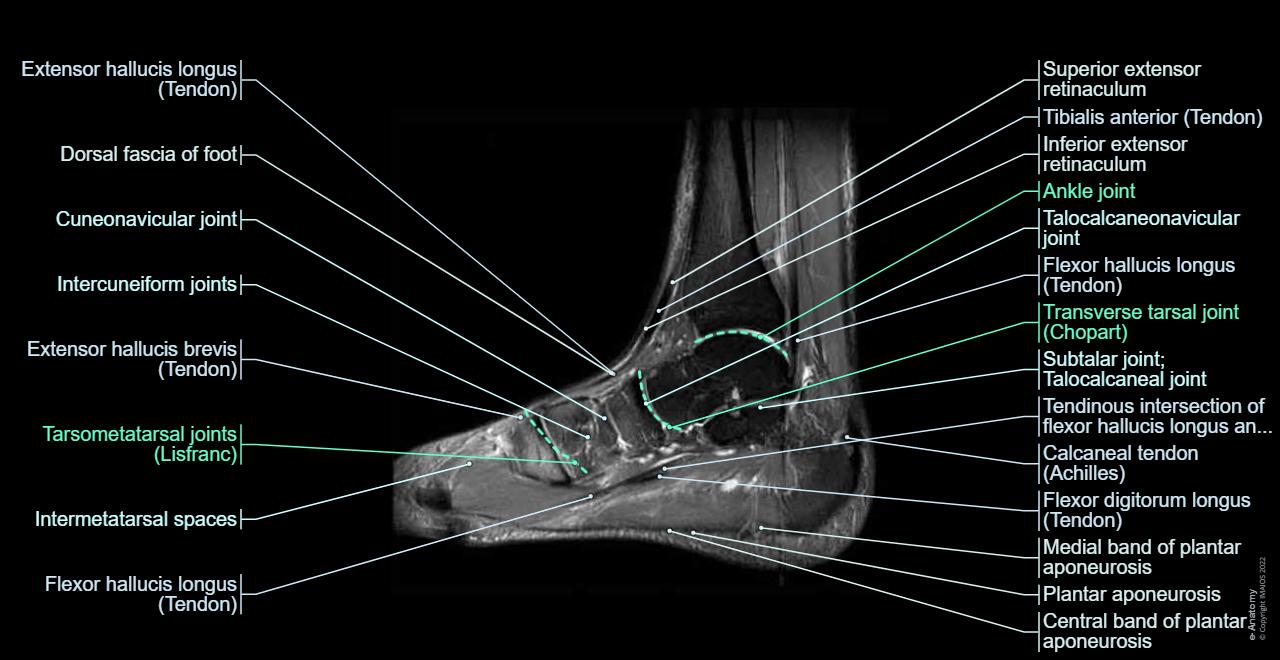 Midfoot Radiology Anatomy of the foot and ankle - MRI | e-Anatomy