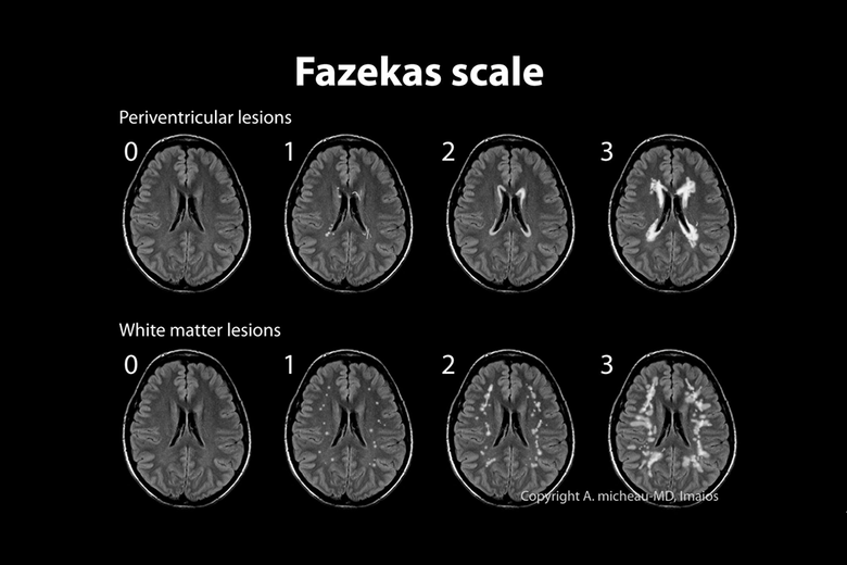 A glossary of commonly used classifications in medical imaging
