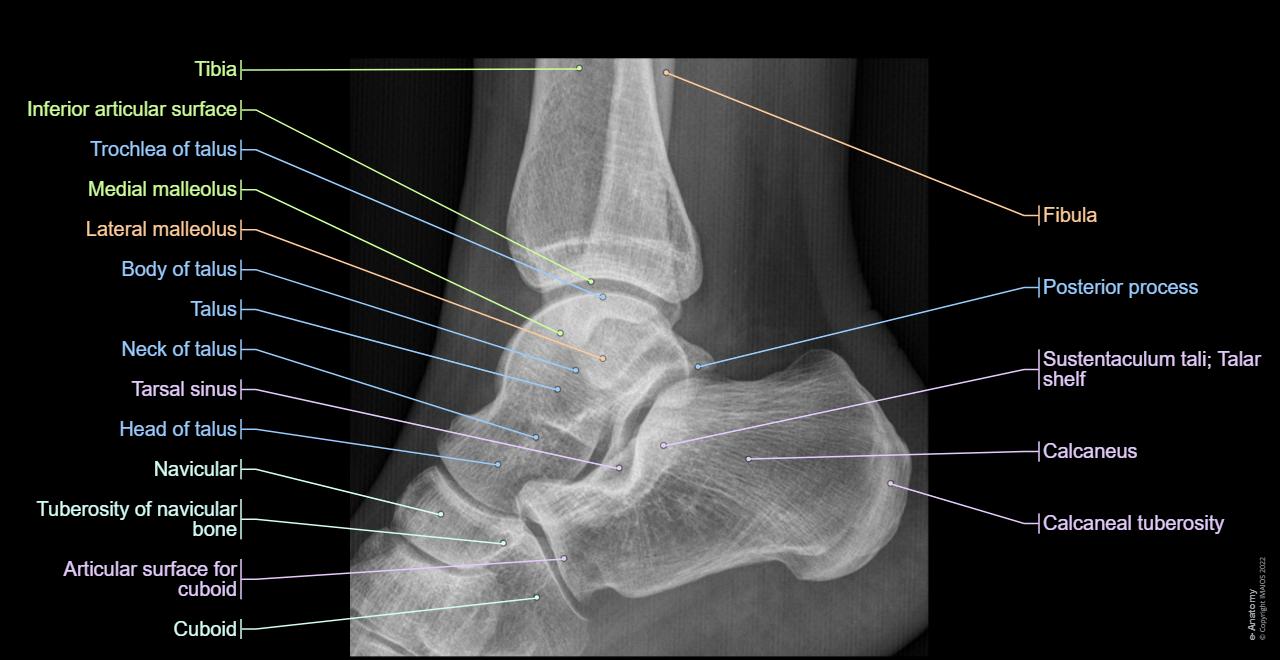 Anatomia radiologica dell’arto inferiore | e-Anatomy