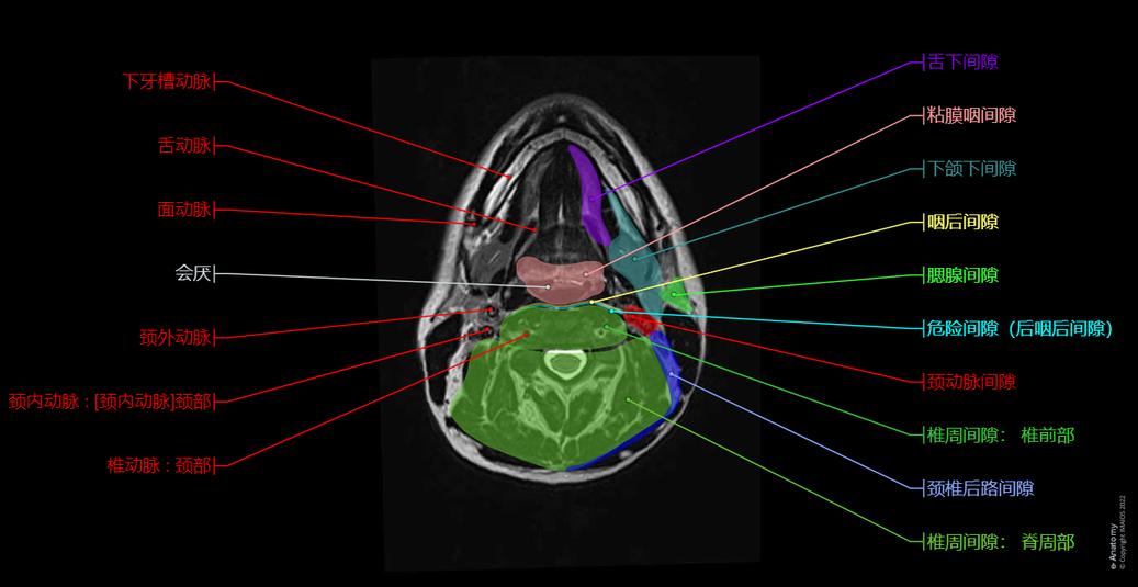 脸与颈部 MRI : 正常解剖 | e-Anatomy