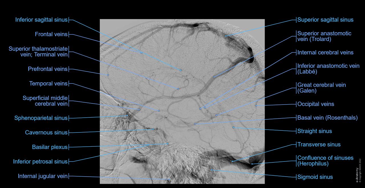 Arteries of brain Angiography: normal anatomy | e-Anatomy