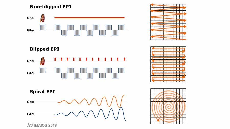 MRI Sequences: Echo planar Imaging (EPI) | e-MRI