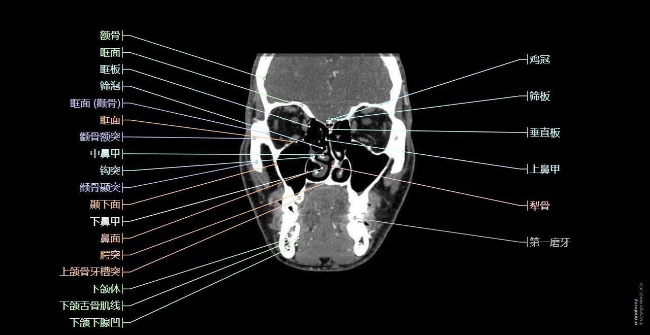 脸 CT : 正常解剖 | e-Anatomy