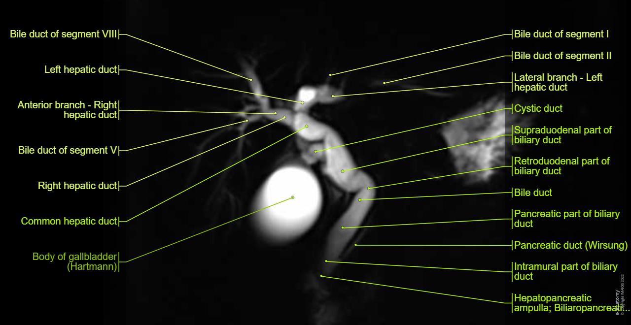 Magnetic Resonance Cholangiopancreatography: normal anatomy | e-Anatomy