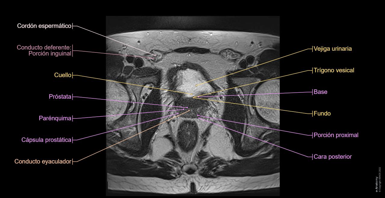 Pelvis Masculina Anatom a Normal E Anatomy pelvis-masculina-anatom-a-normal-e-anatomy