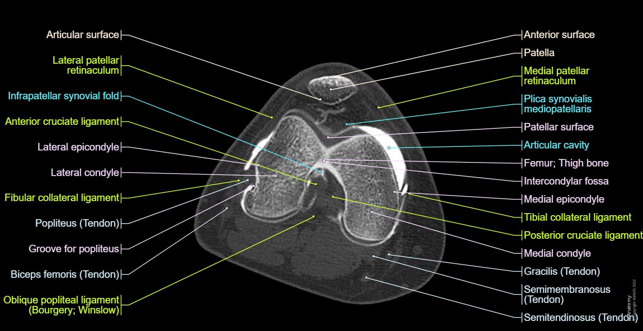 Anatomy of the knee (CT arthrography) | e-Anatomy