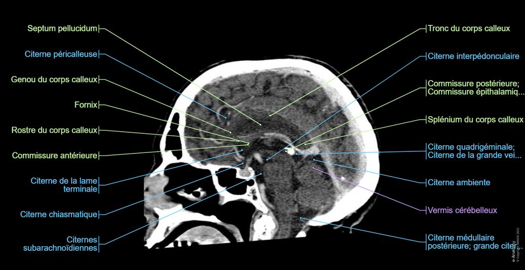 Anatomie Du Cr ne Scanner L gend E Anatomy anatomie-du-cr-ne-scanner-l-gend-e-anatomy