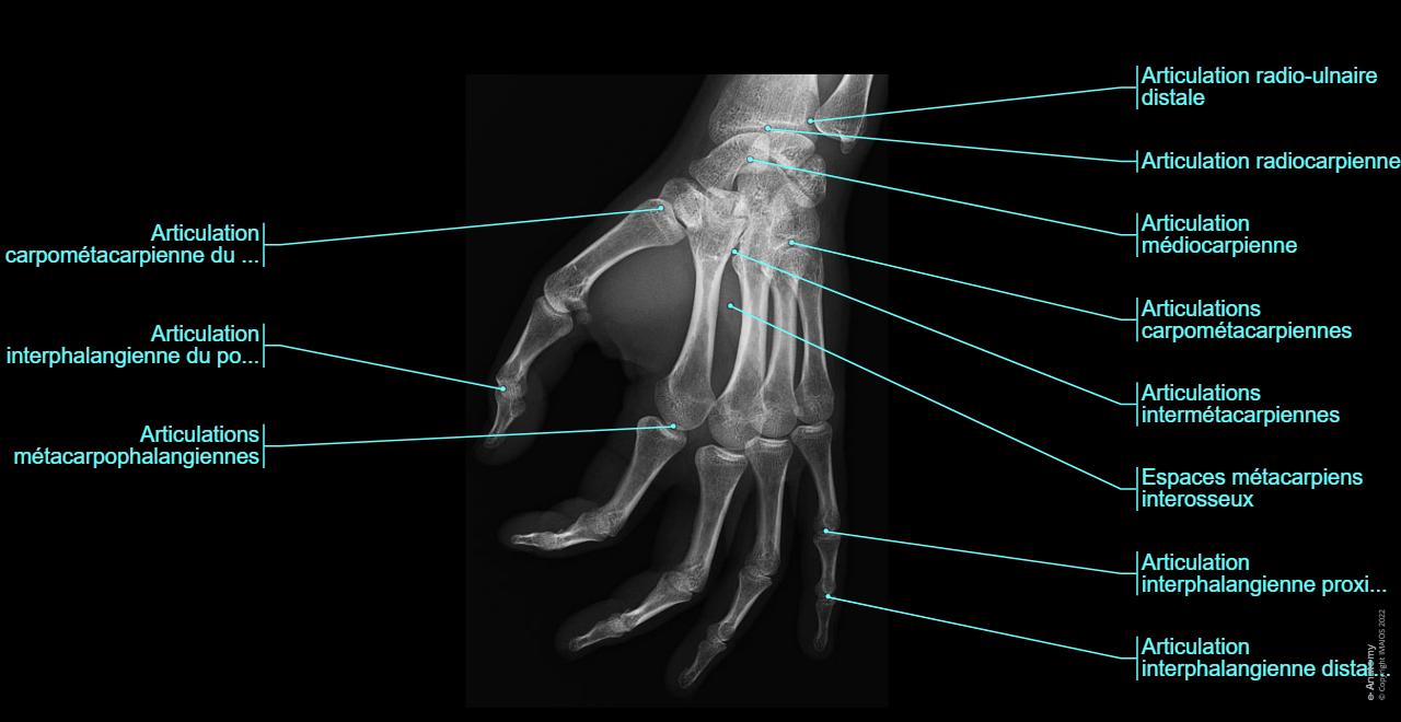Radiographie Des Mains Rayons X Radiographie De La T te Pied T te radiographie-des-mains-rayons-x-radiographie-de-la-t-te-pied-t-te