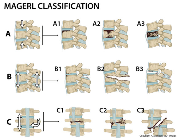 A glossary of commonly used classifications in medical imaging