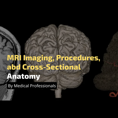 Mri Scanner Intersection MRI Imaging, Procedures, and Cross-Sectional Anatomy