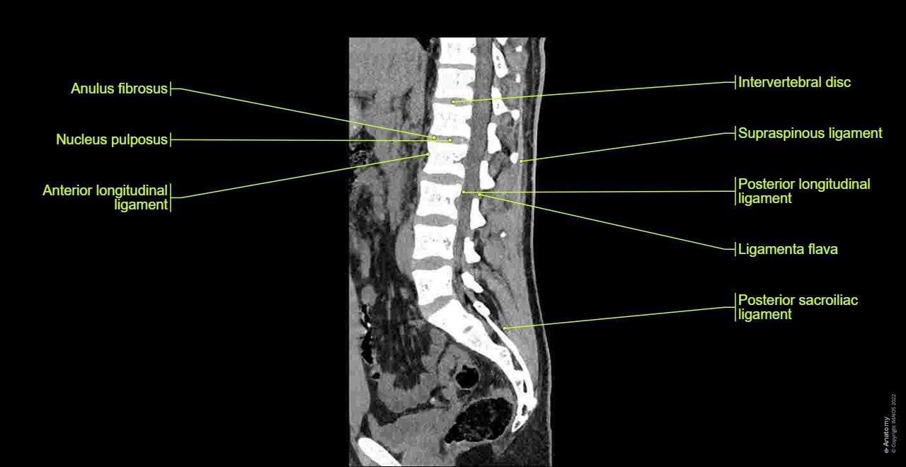 Lumbar Spine Normal Anatomy E Anatomy lumbar-spine-normal-anatomy-e-anatomy