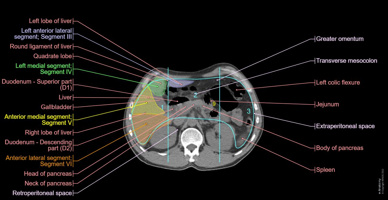 Whole-Body PET-CT: normal anatomy | e-Anatomy