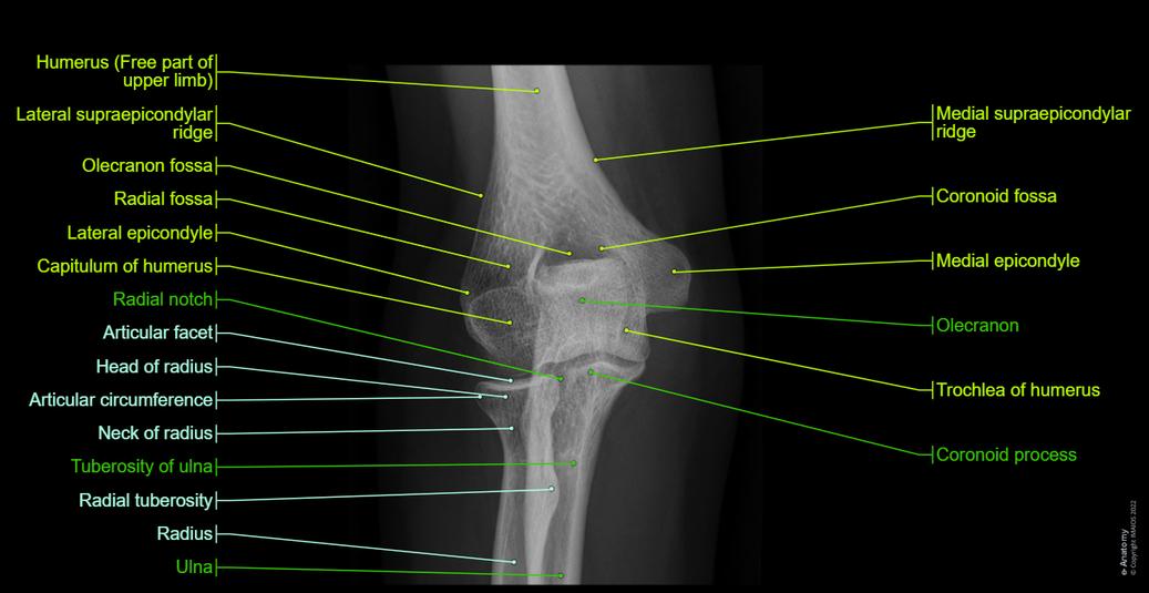 Radiological anatomy of the upper limb : normal anatomy | e-Anatomy