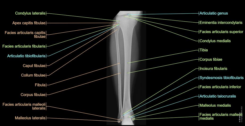 Untere Gliedmaße (Röntgen) | e-Anatomy